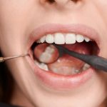 Dentista em Joinville para tratamento de canal quando pode ser necessário