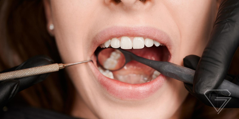 Dentista em Joinville para tratamento de canal quando pode ser necessário